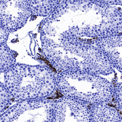 Perilipin-1 Recombinant Rabbit mAb (S-3093-31)