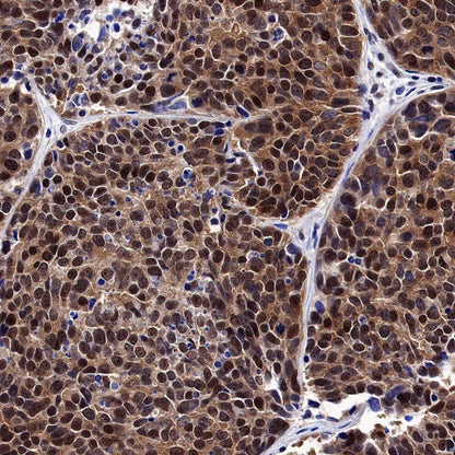 Keap1 Recombinant Rabbit mAb (S-1520-8)