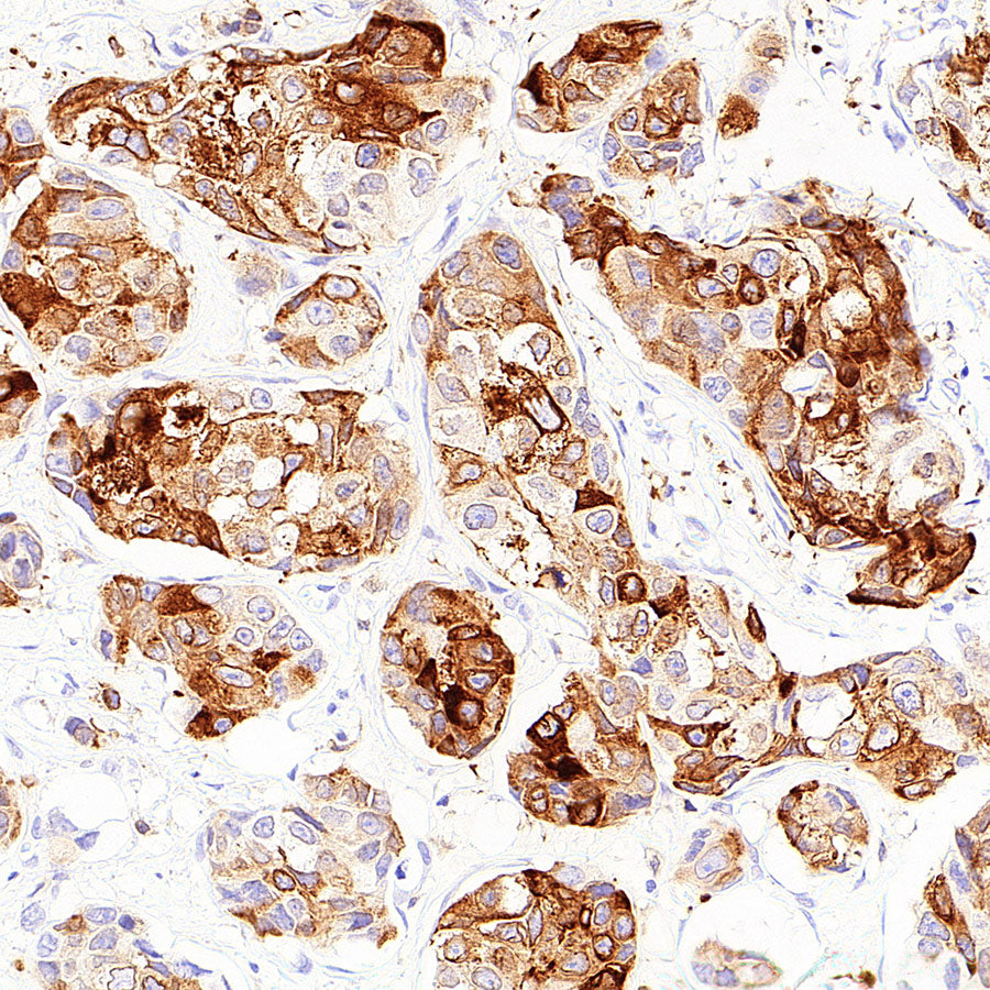 SCD Recombinant Rabbit mAb (S-4467-1)