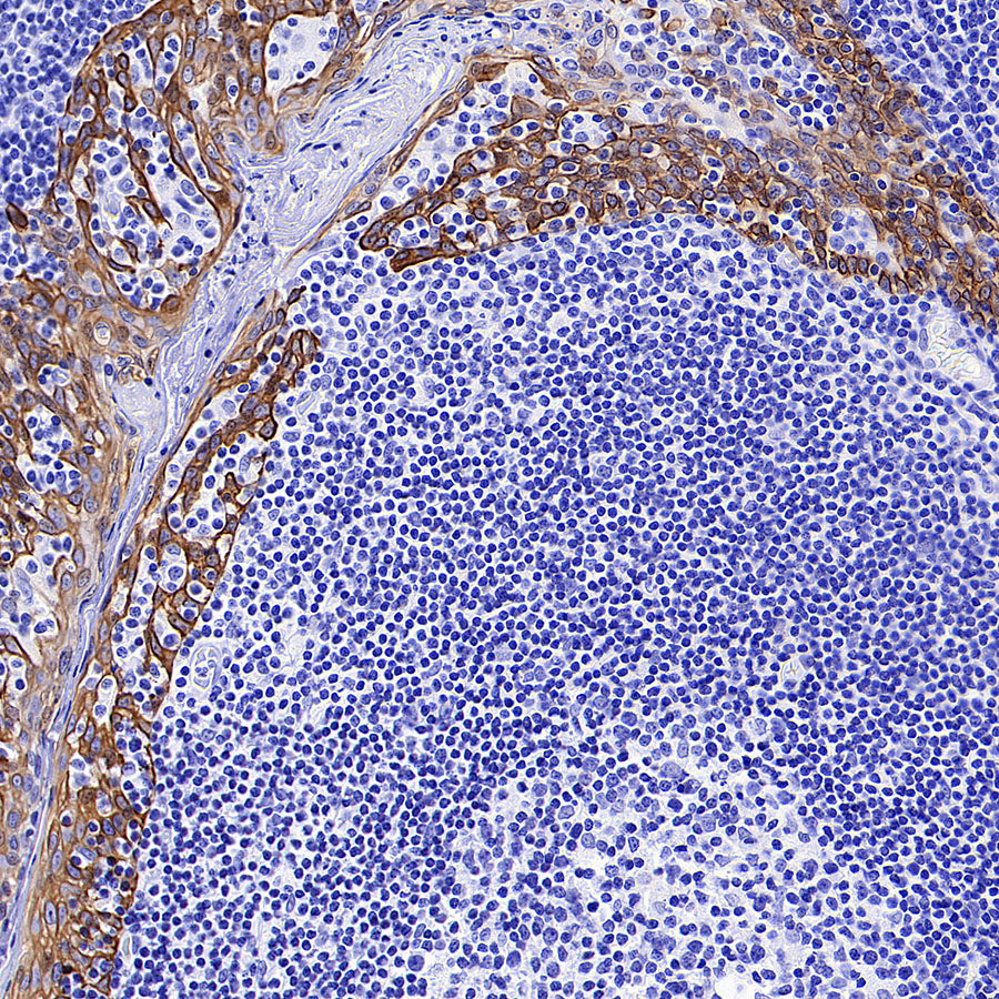 Cytokeratin 14 Recombinant Mouse mAb (S-M0003)