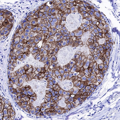 p120 Catenin Recombinant Rabbit mAb (SDT-350-75)