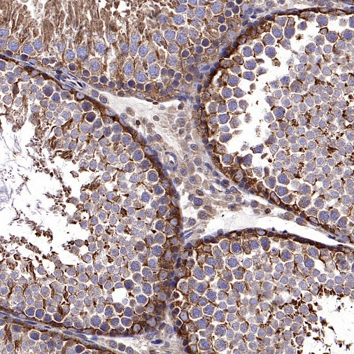 PTP1B Rabbit Polyclonal Antibody