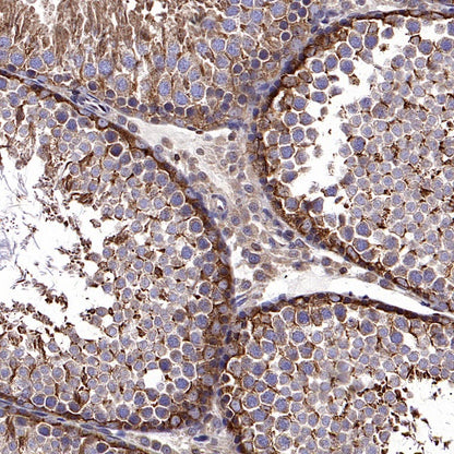 PTP1B Rabbit Polyclonal Antibody