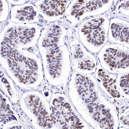 Phospho-Histone H3 (Ser28) Recombinant Rabbit mAb (S-1025-45)