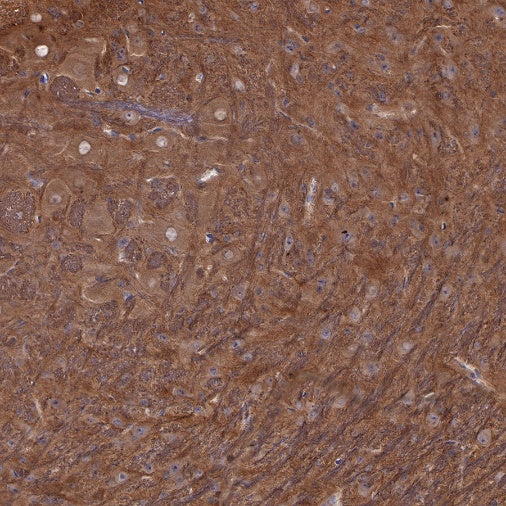 LC3B Recombinant Rabbit mAb (S-477-89)