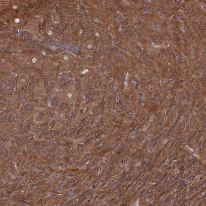 LC3B Recombinant Rabbit mAb (S-477-89)