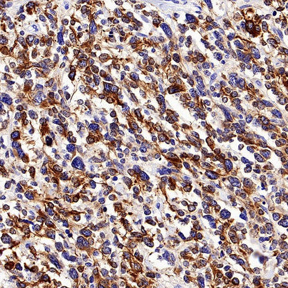 MAP2 Recombinant Rabbit mAb, PBS Only (SDT-2060-28)