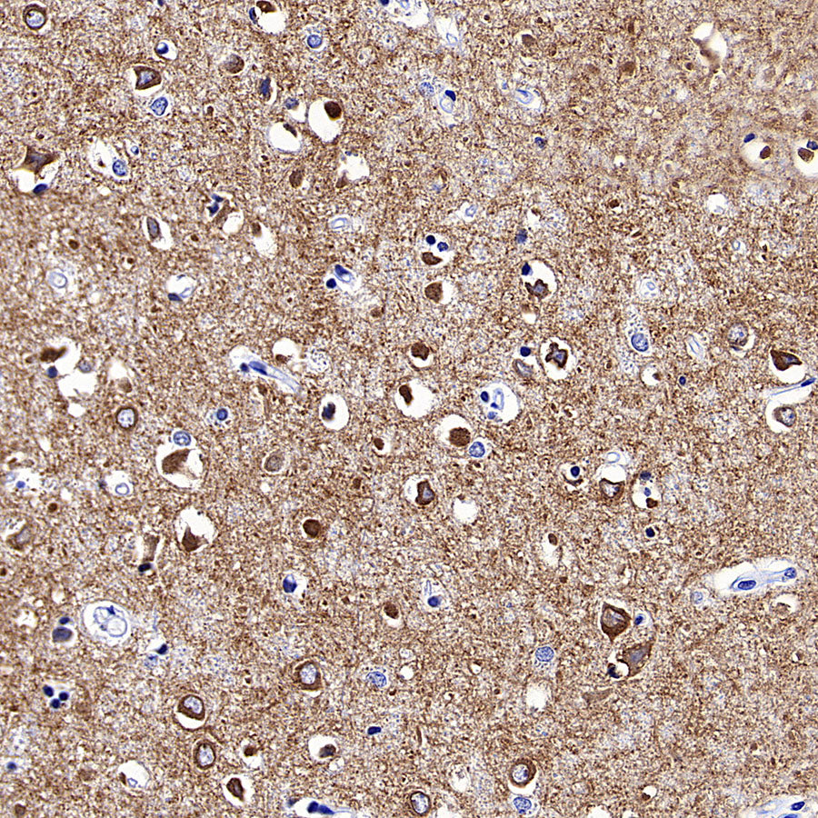 GRIA2 Recombinant Rabbit mAb (S-3446-123)