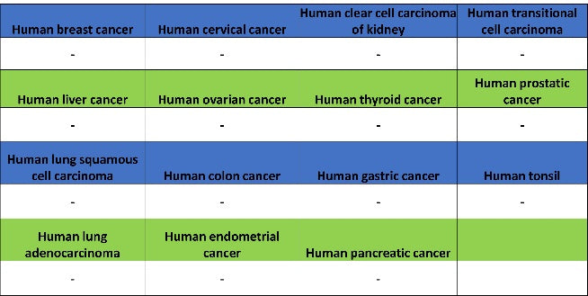 Sarcomeric Alpha Actinin Recombinant Rabbit mAb (S-1652-40)