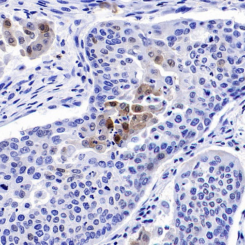 p27 Kip1 Recombinant Rabbit mAb (SDT-361-310)