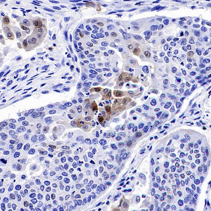 p27 Kip1 Recombinant Rabbit mAb (SDT-361-310)