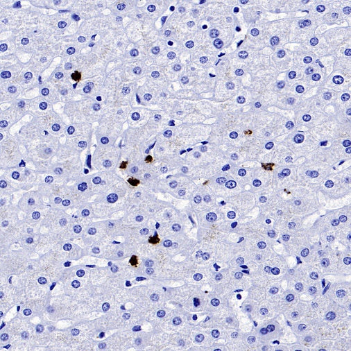 Lipocalin-2/NGAL Recombinant Rabbit mAb (S-2279-72)