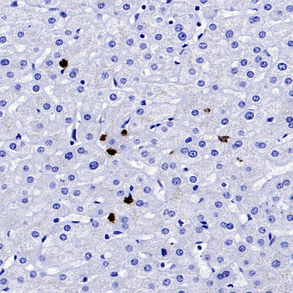 Lipocalin-2/NGAL Recombinant Rabbit mAb (S-2279-72)
