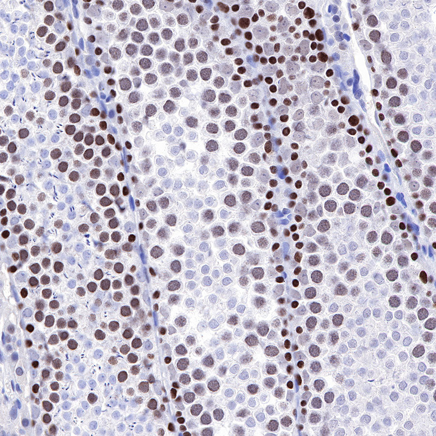 S-RMab® MSH6 Recombinant Rabbit mAb,PBS Only (SDT-R094)