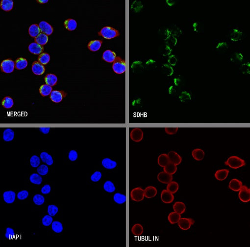 SDHB Recombinant Rabbit mAb (SDT-1162-2)