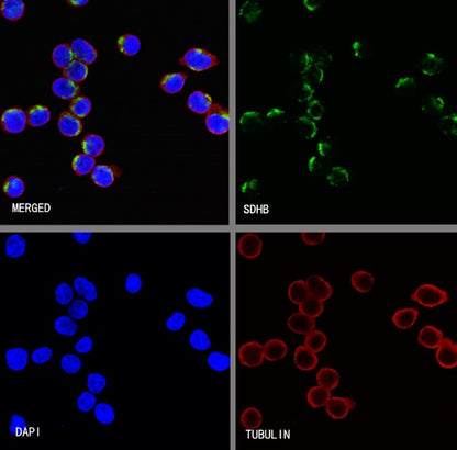 SDHB Recombinant Rabbit mAb (SDT-1162-2)