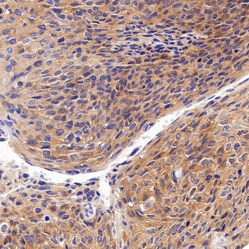 ATG9A Recombinant Rabbit mAb (S-1418-5)