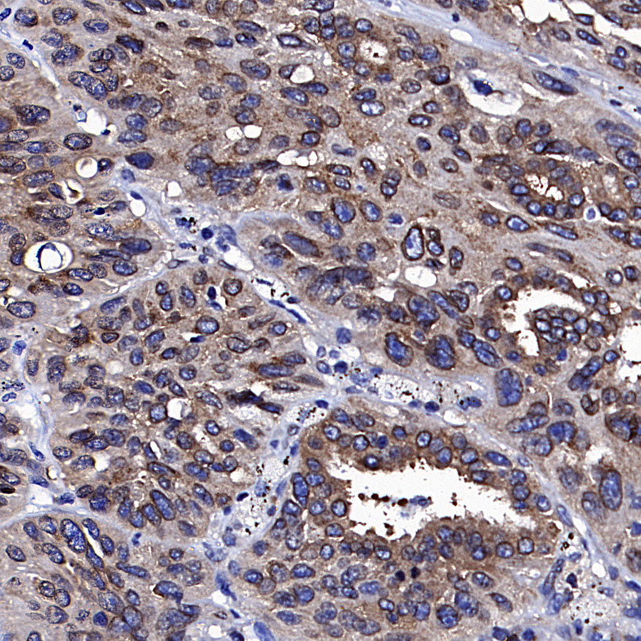 Golgin-245 Recombinant Rabbit mAb (S-4473-8)