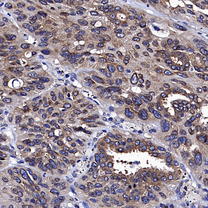 Golgin-245 Recombinant Rabbit mAb (S-4473-8)