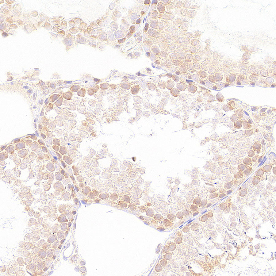 EIF2S2 Rabbit Polyclonal Antibody