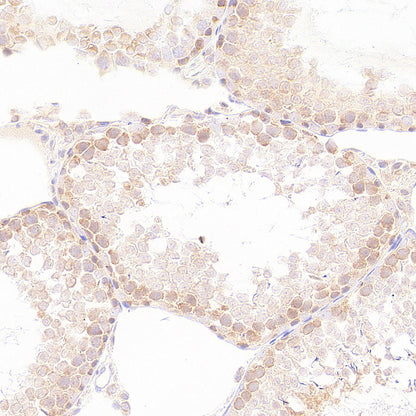 EIF2S2 Rabbit Polyclonal Antibody