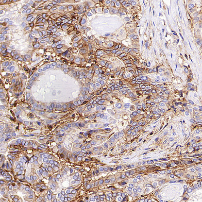 HLA-ABC Recombinant Rabbit mAb (S-3995-2)