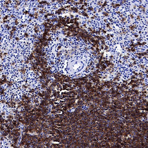CD37 Recombinant Rabbit mAb (S-1662-61)