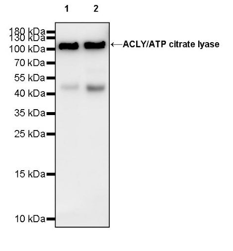 ACLY/ATP citrate lyase Recombinant Rabbit mAb (S-2025-32)
