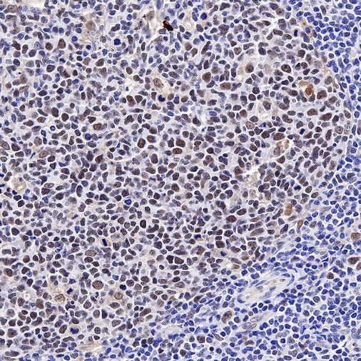 MCM6 Recombinant Rabbit mAb (S-899-23)