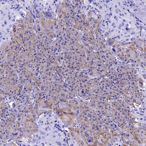 StAR Recombinant Rabbit mAb (S-2520-24)