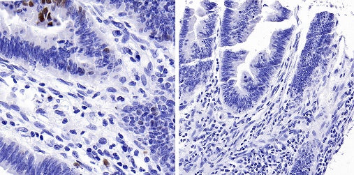 Phospho-Rb (Ser807/811) Recombinant Rabbit mAb (S-2215-52)