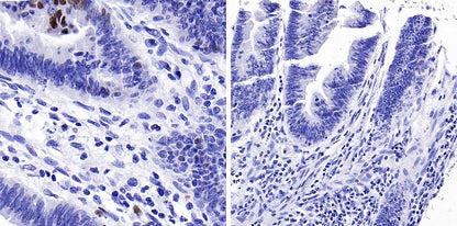 Phospho-Rb (Ser807/811) Recombinant Rabbit mAb (S-2215-52)