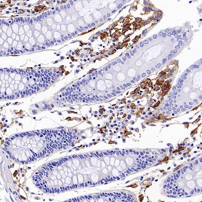 NINJ1 Recombinant Rabbit mAb (S-3109-56)