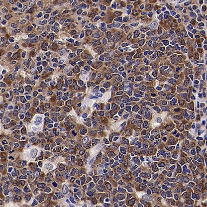 HSP90 Recombinant Rabbit mAb (S-5412)