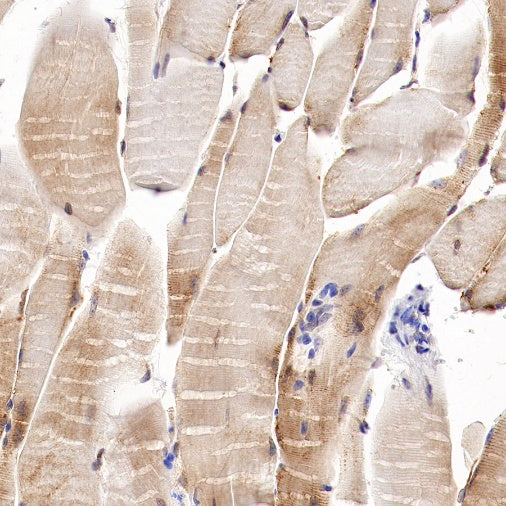 Trim30a Recombinant Rabbit mAb (S-1753-35)