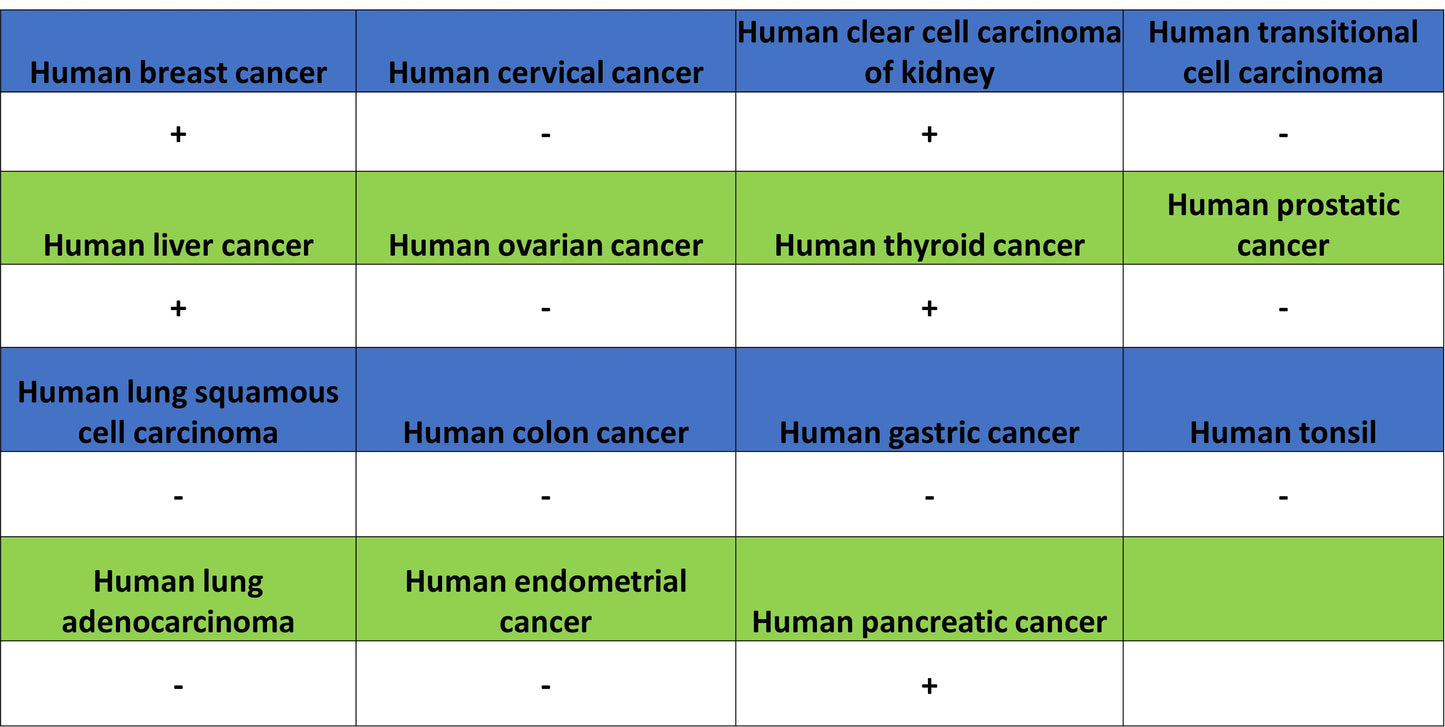 KIRREL2 Recombinant Rabbit mAb (S-4624-78)