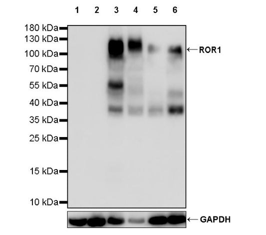 ROR1 Recombinant Rabbit mAb (SDT-R502-2)
