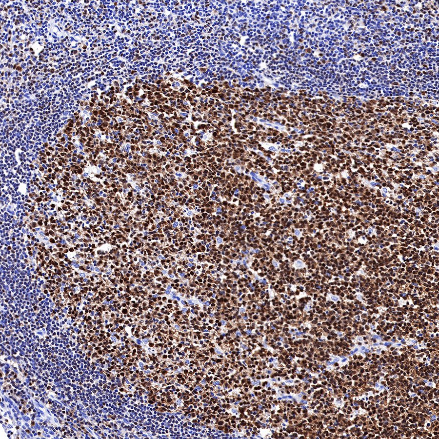 BOB-1 Recombinant Rabbit mAb (SDT-263-55)