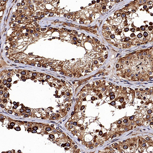 Calnexin Rabbit Polyclonal Antibody