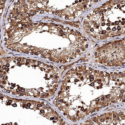 Calnexin Rabbit Polyclonal Antibody