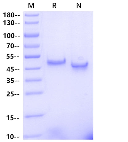 CBLB/RNF56(36-426) Protein, Human