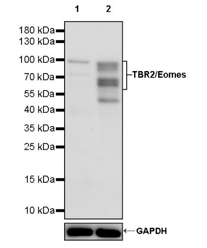 TBR2/Eomes Recombinant Rabbit mAb (S-1101-123)