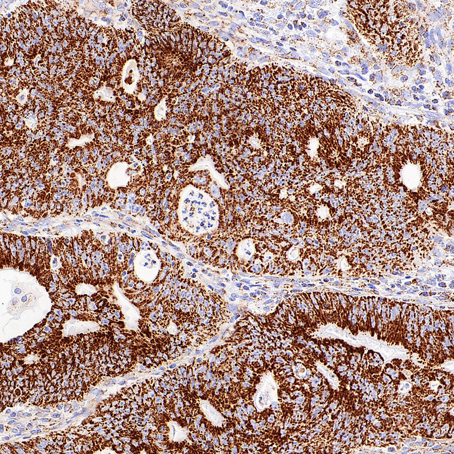 TFAM Recombinant Rabbit mAb