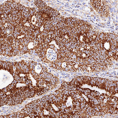 TFAM Recombinant Rabbit mAb