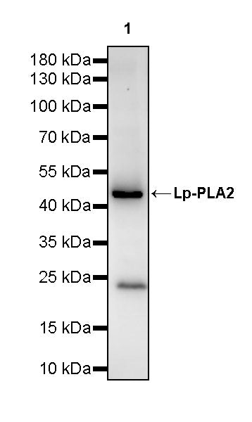 Lp-PLA2 Recombinant Rabbit mAb (S-3711-113)