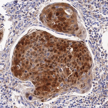 ALDH3A1 Recombinant Rabbit mAb (S-R220)