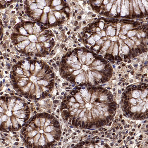 Superoxide dismutase Rabbit Polyclonal Antibody
