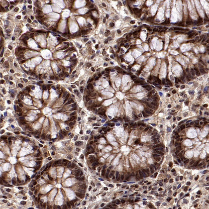 Superoxide dismutase Rabbit Polyclonal Antibody