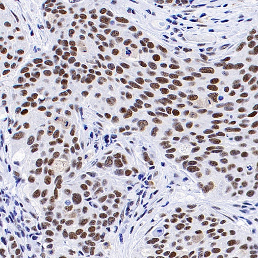CDK9 Rabbit Polyclonal Antibody
