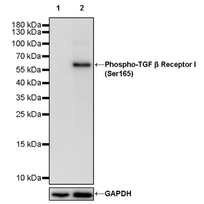 Phospho-TGF β Receptor I(Ser165) Recombinant Rabbit mAb (S-1896-21)